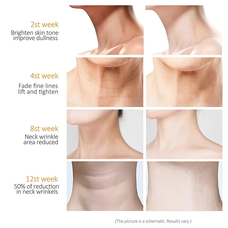 Collagen Neck Cream Eliminate Neck Wrinkle Lines Lifting Whitening Tighten Double Chin Anti-Age Rejuvenation Skin Care Products
