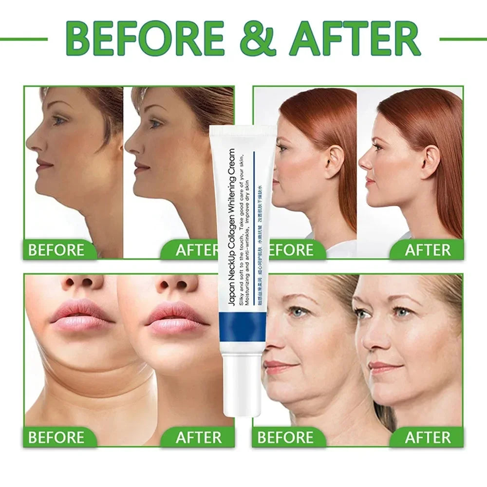 Collagen Neck Cream Eliminate Neck Wrinkle Lines Lifting Whitening Tighten Double Chin Anti-Age Rejuvenation Skin Care Products